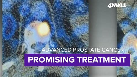 New Treatment For Advanced Prostate Cancer Shows Progress YouTube
