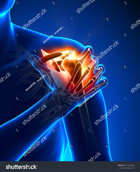 Shoulder Pain Anatomy Concept Stock Illustration 129509480 Shutterstock