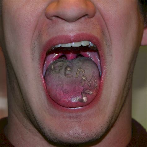 Viral Online News What Does Your Tongue Indicate About Your Health
