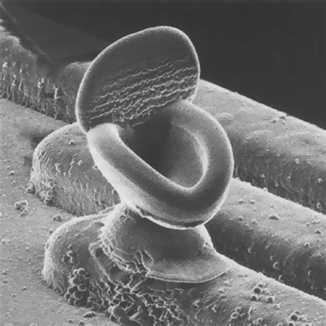 Electron Microscope Photos Of Common Things Micropedia