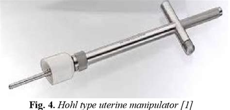 Cooper surgical advincula arch , reusable uterine manipulator handle ref: Open Access Journals Online - Scientific, Academic ...