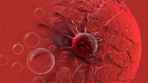 Combination Therapy May Improve Treatment Of Blood Cancer