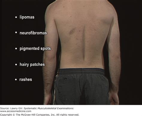 The Regional Musculoskeletal Examination Of The Low Back