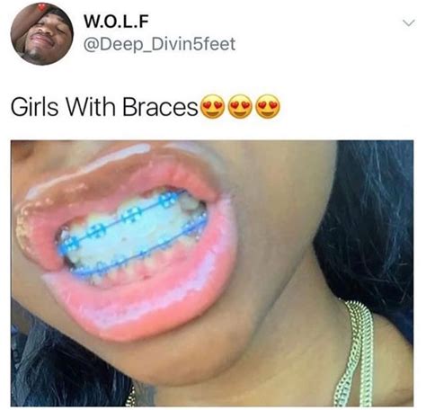 Good Braces Colors For Blondes In 2023