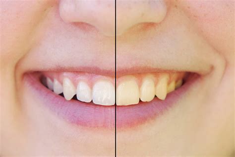 Your teeth should stay naturally white if you brush regularly and avoid excess tea, coffee and red wine. How to Avoid Staining Teeth When Drinking Coffee