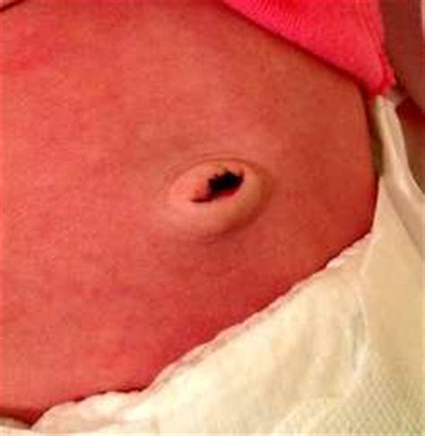 Just about any time of day can be the right time for a bath. 2 Weeks Old, Dr Gregory Gordon discusses topics important ...