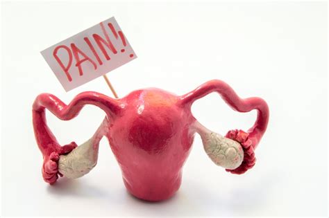 Ovary Pain Major Causes Anatomy Treatment Options