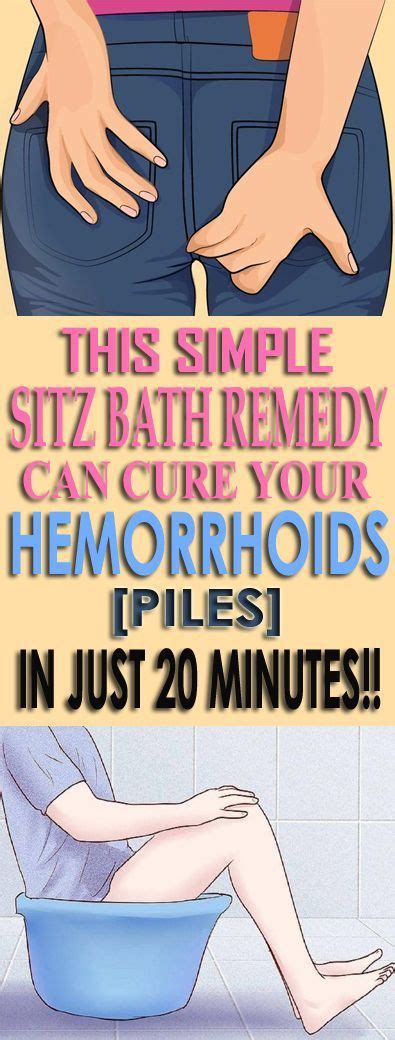 This Simple Sitz Bath Remedy Can Cure Your Hemorrhoidspiles In Just