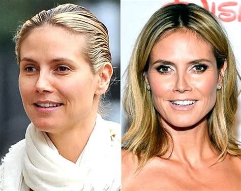 Heidi Klum Plastic Surgery Before And After Botox Injections Celebie