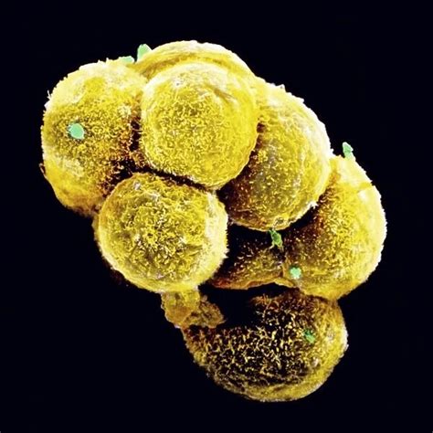 Coloured Sem Of An Embryo At The Stage Of Morula Photos Framed Prints