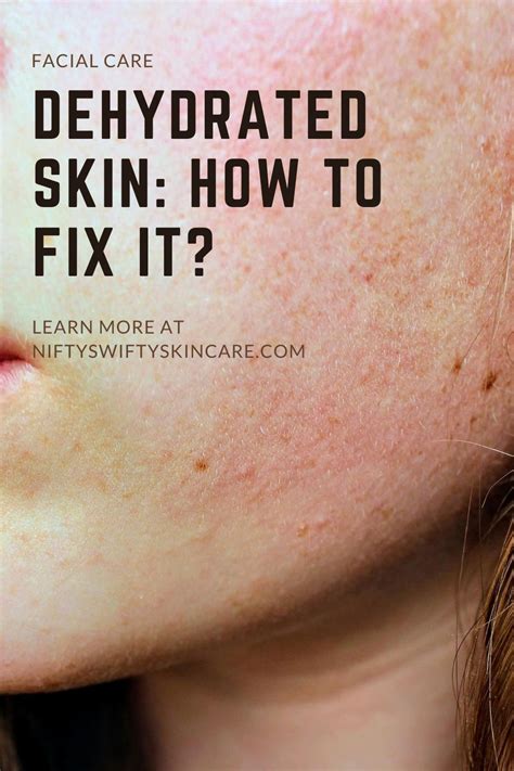 How To Fix Dehydrated Skin Face Dry Skin Remedies Flaky Skin On Face