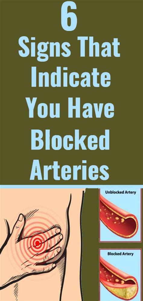 600 x 400 jpeg 52 кб. 6 Warning Signs of Clogged Arteries - popularrecipespins ...