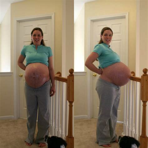 Triplet Pregnancy Pregnant With Triplets Belly Pregnant Belly Huge