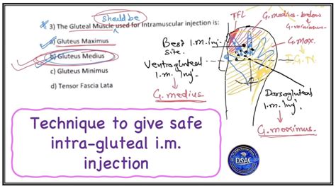 Correct Technique To Give Deep Intramuscular Injection How To Give Safe Intragluteal Im