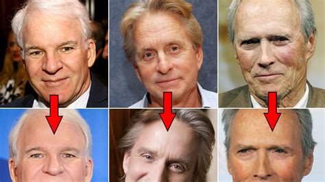 Steve Martin Simon Cowell And More Male Celebs Who May Have Had Plastic Surgery Photos