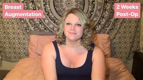 Breast Augmentation Update Weeks Post Op My Transgender Journey YouTube