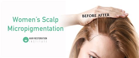 Scalp Micropigmentation Women Hair Restoration Institute