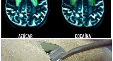 El Azúcar Provoca Los Mismos Efectos Que La Cocaína En El Cerebro Miscelanea Correo
