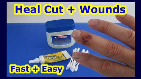 Heal Cut Wounds Faster And Easier The Quick Way To Heal Cuts Wound