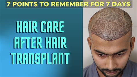 How To Take Care Of Hair After Hair Transplant First Days Hair
