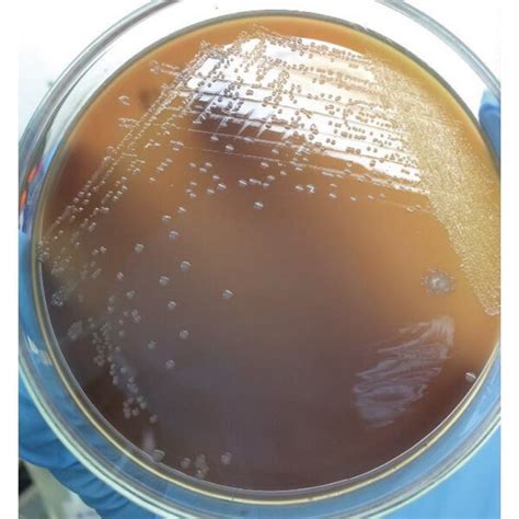 P Multocida Colonies Growing On Sheep Blood Agar A And Their