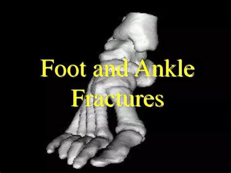 Ppt Foot And Ankle Fractures Powerpoint Presentation Free Download