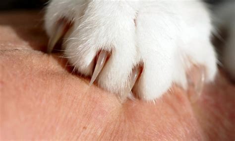 They can curl round and even grow into the foot. Top Reasons Why a House Cats Claws Keep Hooking on Things ...