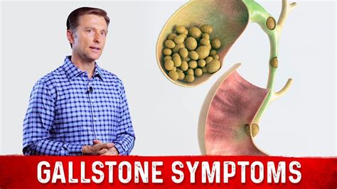 Gallstone Symptoms And Causes Explained Drberg On Gallbladder Stone
