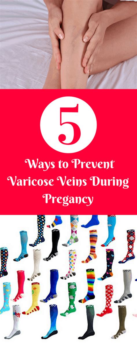 How To Deal With Varicose Veins During Pregnancy Maternity Comfort