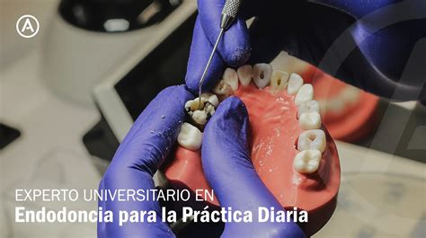 Cursos De Endodoncia Autrán Dental Academy