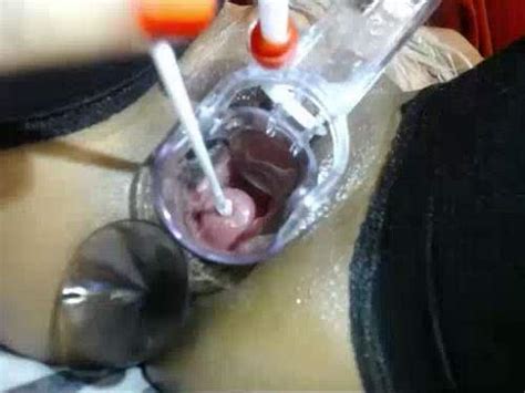 Stunning Webcam Girl Very Close Speculum Cunt Close Up Speculum Pussy Download Free Fisting