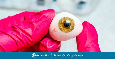 Implantan Con éxito La Primera Prótesis Ocular Impresa En 3d