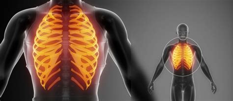 The Link Between Back Pain And Rib Pain Dr Stefano Sinicropi