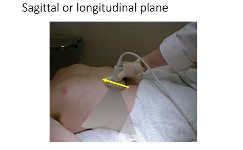Ultrasound Basics Sagittal Plane
