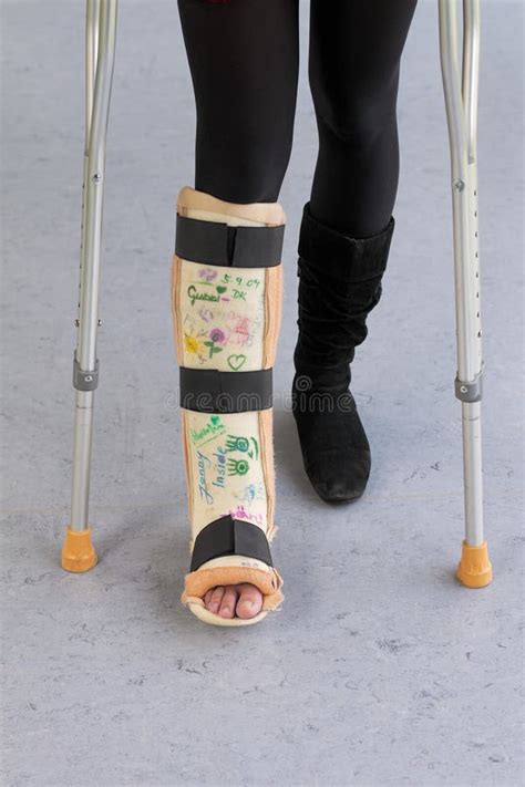 Leg Cast And Crutches Stock Photo Image Of Injured Legs 11342606