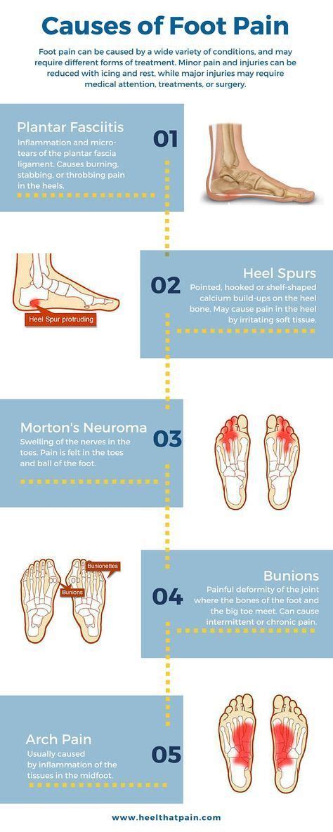 143 Best Images About Health Foot On Pinterest Foot