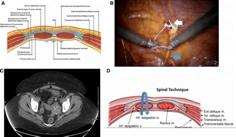 Anatomy Below The Arcuate Line And Location Of The Spiral Technique