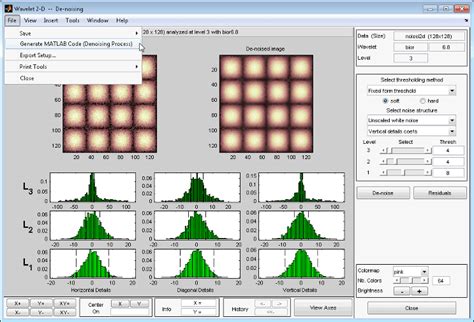 Signal processing stack exchange is a question and answer site for practitioners of the i need to segment liver from an abdominal ct image using adaptive thresholding. Generate MATLAB Code for 2-D Decimated Wavelet Denoising ...