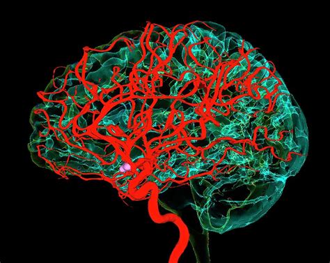 Blood Vessels Supplying The Brain Photograph By K H Fungscience Photo