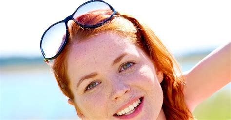 Redheads At Risk For Melanoma Skin Cancer Can Develop Without The Sun