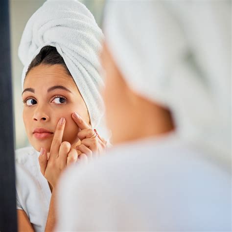 The 7 Best Acne Spot Treatments To Get Rid Of A Pimple Fast In 2020