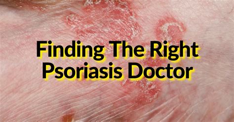 Finding The Right Psoriasis Doctor The Office Of Dr Brad Shook Dc