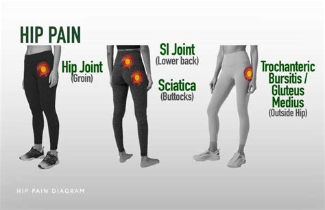 Various Causes Of Hip Pain A Blog Post From Emed