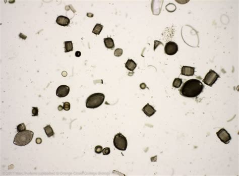 Diatoms At 100x A Slide Of Preserved Diatoms Seen At 100x Flickr