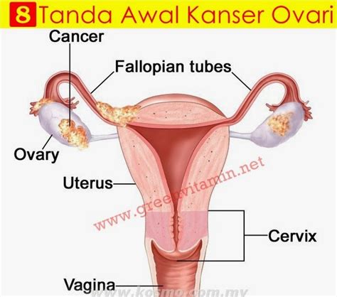 Keadaan ini mungkin berkait rapat dengan perubahan yang berlaku pada sistem usus perut atau tanda awal menghidap kanser ovari. Ketahui 8 Tanda Awal Kanser Ovari - X nak gemuk