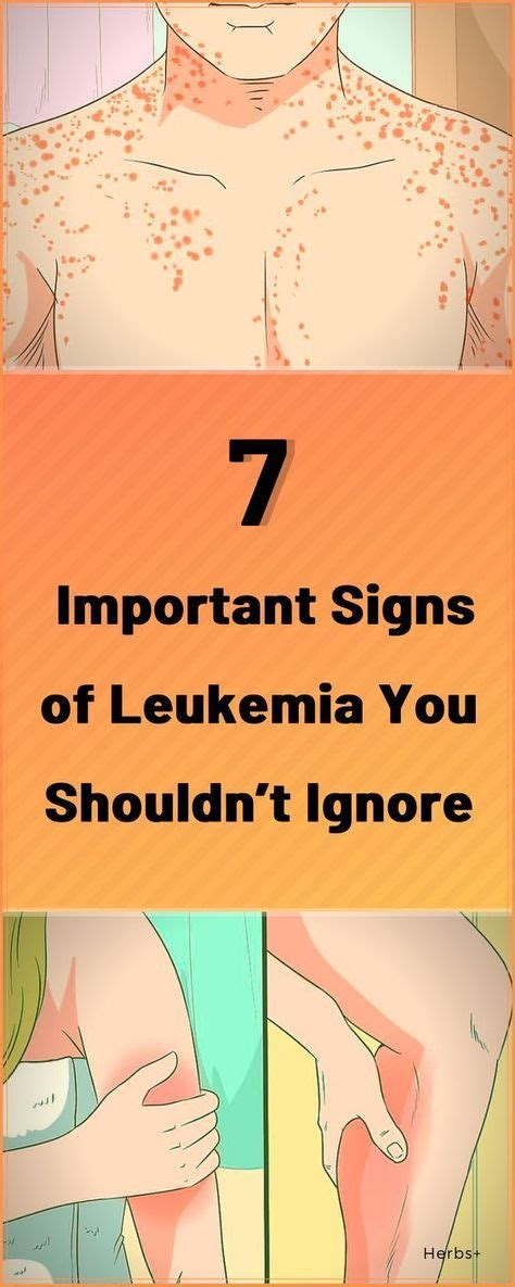 7 Important Signs Of Leukemia You Shouldnt Ignore Leukemia Leukemia