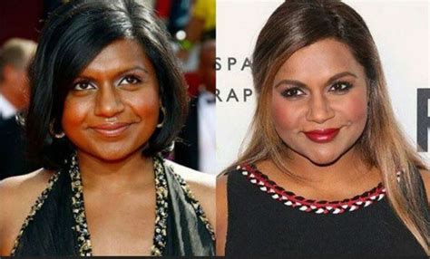 Mindy Kaling Plastic Surgery Before And After Surgery Photos How She