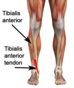 Another front leg deformity which commonly occurs is called elbow dysplasia. NYC Marathon Training (Part 3) The Anterior Tibialis a.k.a ...