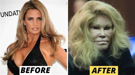 Celebrity Plastic Surgery Disasters Youtube In Bad Celebrity Plastic Surgery