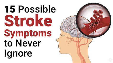 8 Warning Signs Of A Stroke You Should Never Ignore